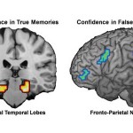 brain