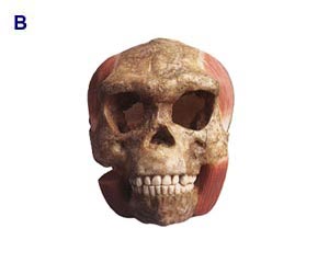 Cast is rounded out with teeth, lower jaw, and chewing muscles.