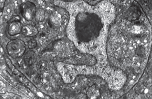 C_elegans_cell_death