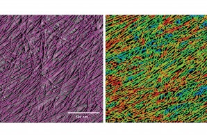 Stretching and Loosening